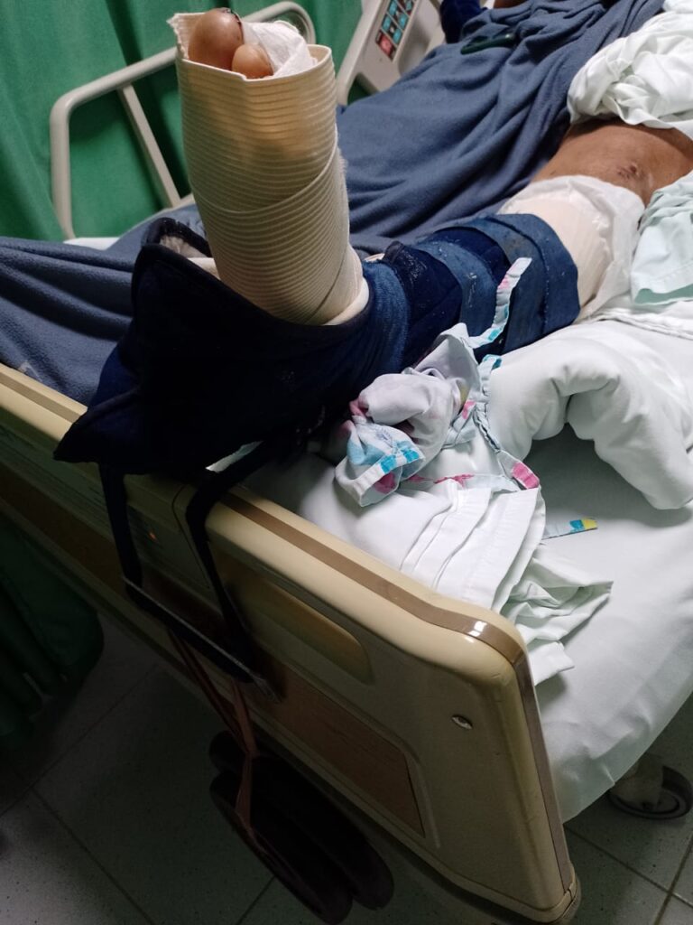 "Accidente" en Montelíbano que protagonizó empleado de Cerro Matoso genera indignación