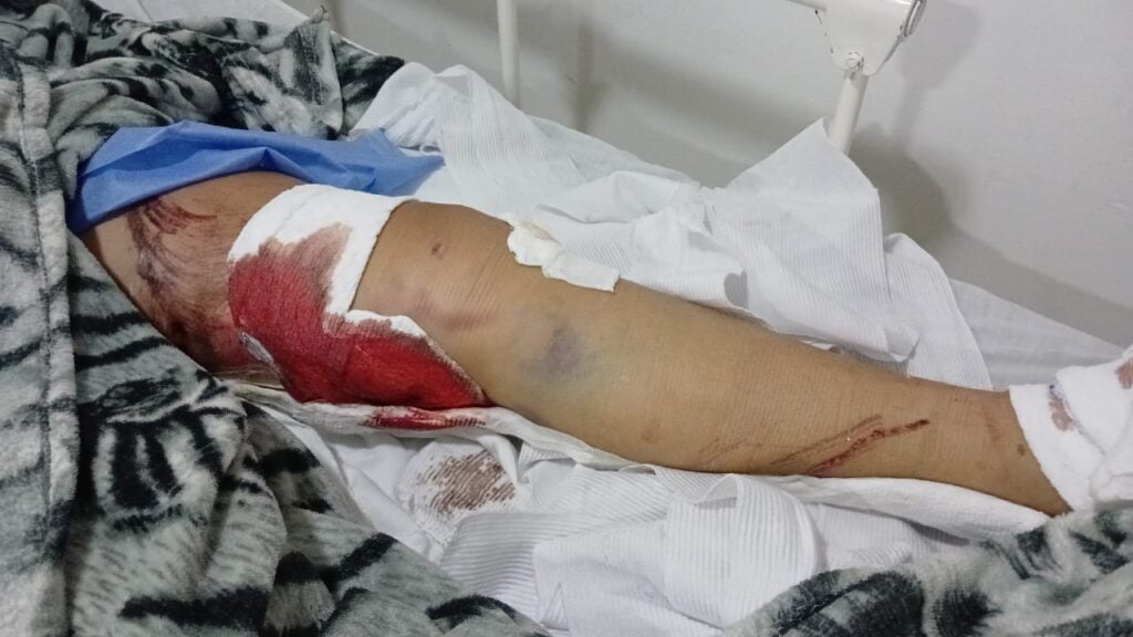 "Accidente" en Montelíbano que protagonizó empleado de Cerro Matoso genera indignación
